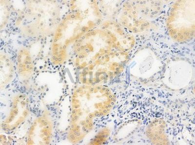 UNC5C Antibody - DF2214 at 1/100 staining human normal kidney tissue by IHC-P.