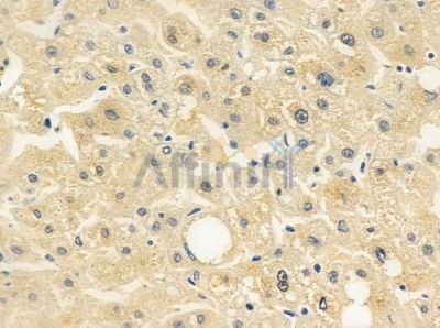 UNC5C Antibody - DF2214 at 1/100 staining human normal liver tissue by IHC-P.