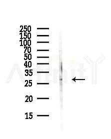 SYF2 Antibody - Western blot analysis of lysates from Hela cells(heat-shock,45min treatment), using SYF2 Antibody at 1/1000 dilution.