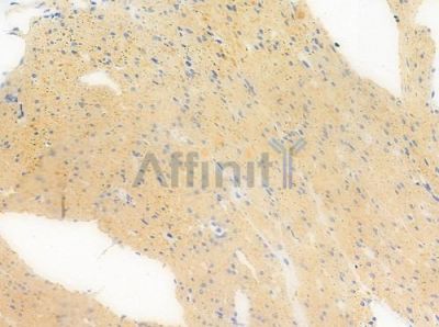 RFPL1 Antibody - DF2231 at 1/100 staining human normal colon tissue by IHC-P.
