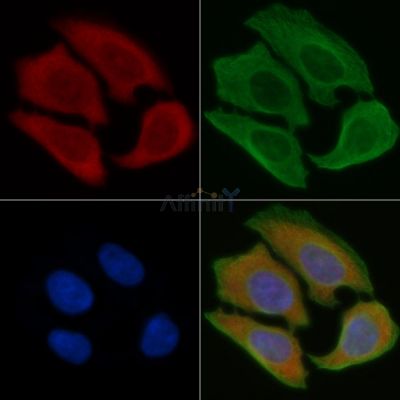 ATP6V1D Antibody - DF2263 staining Hela cells(45min of heat-shock) by IF/ICC.