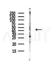 ACTC1 Antibody - Western blot analysis of lysates from HUVEC cells(UV,30min treatment), using ACTC1 Antibody at 1/1000 dilution.