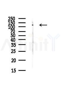 CCAR1 Antibody - Western blot analysis of lysates from Hela cells(heat-shock,45min treatment), using CCAR1 Antibody at 1/1000 dilution.
