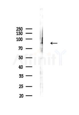 CENPI Antibody - Western blot analysis of lysates from 293 cells(heat-shock,45min treatment), using CENPI Antibody at 1/1000 dilution.