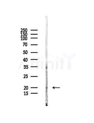 CENPR Antibody - Western blot analysis of lysates from PC12 cells, using CENPR Antibody at 1/1000 dilution.