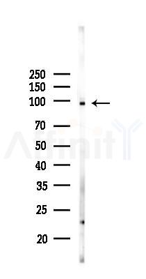 CUL4B Antibody - Western blot analysis of lysates from MCF7 cells(heat-shock,45min treatment), using CUL4B Antibody at 1/1000 dilution.