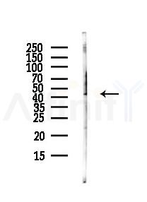 CXCR3 Antibody - Western blot analysis of lysates from HUVEC cells(UV,30min treatment), using CXCR3 Antibody at 1/1000 dilution.