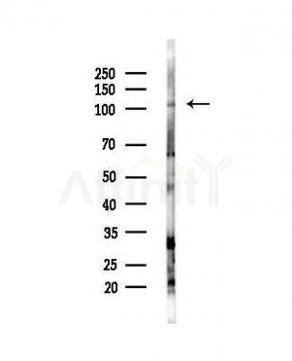 NIK Antibody - Western blot analysis of lysates from B16F10-LUC cells(heat-shock,45min treatment), using NIK Antibody at 1/1000 dilution.