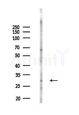 RAD1 Antibody - Western blot analysis of lysates from B16F10-LUC cells(starvation,24h treatment), using RAD1 Antibody at 1/1000 dilution.