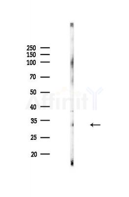 TTC19 Antibody - Western blot analysis of lysates from MDA-MB-231 cells(heat-shock,45min treatment), using TTC19 Antibody at 1/1000 dilution.