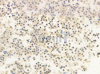 JMJD1B Antibody - DF2417 at 1/100 staining human pituitary adenoma by IHC-P.