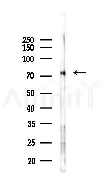 NUFIP2 Antibody - Western blot analysis of lysates from B16F10-LUC cells(uv30min treatment), using NUFIP2 Antibody at 1/1000 dilution.