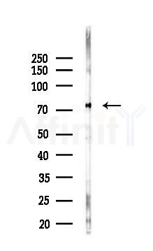 NUFIP2 Antibody - Western blot analysis of lysates from K562 cells(uv30min treatment), using NUFIP2 Antibody at 1/1000 dilution.