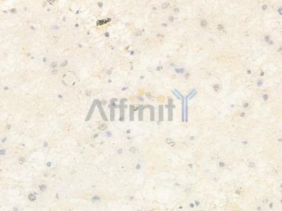 TAF15 Antibody - DF2424 at 1/100 staining human astrocytoma by IHC-P.