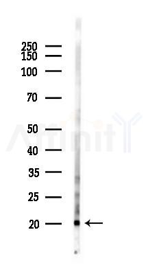 GKN2 Antibody - Western blot analysis of lysates from 293 cells(UV,30min treatment), using GKN2 Antibody at 1/1000 dilution.