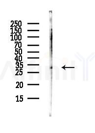 WNT8B Antibody - Western blot analysis of lysates from HUVEC cells(UV,30min treatment), using WNT8B Antibody at 1/1000 dilution.