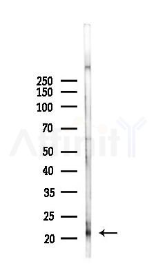 ARL11 Antibody - Western blot analysis of lysates from K562 cells(heat-shock,45min treatment), using ARL11 Antibody at 1/1000 dilution.