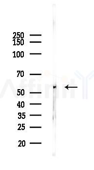BTBD14B Antibody - Western blot analysis of lysates from Hela cells(LPS, 4h treatment), using BTBD14B Antibody at 1/1000 dilution.