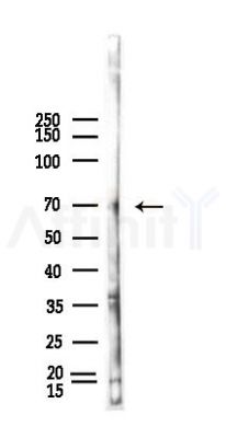TSYL2 Antibody - Western blot analysis of lysates from HUVEC cells(heat-shock,45min treatment), using TSYL2 Antibody at 1/1000 dilution.