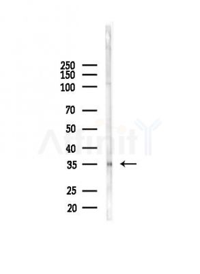 VSX1 Antibody - Western blot analysis of lysates from HepG2 cells(heat-shock, 45min treatment), using VSX1 Antibody at 1/1000 dilution.