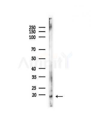 L36mt Antibody - Western blot analysis of lysates from HepG2 cells(starvation,24h treatment), using L36mt Antibody at 1/1000 dilution.
