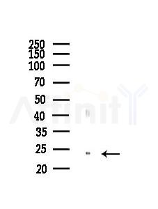 HSPB8 Antibody - Western blot analysis of lysates from Mouse liver, using HSPB8 Antibody at 1/1000 dilution.