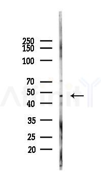 ABCG2 Antibody - Western blot analysis of lysates from Hela cells(LPS, 4h treatment), using ABCG2 Antibody at 1/1000 dilution.