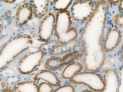 RRP7 Antibody - DF2485 at 1/100 staining human normal kidney tissue by IHC-P.