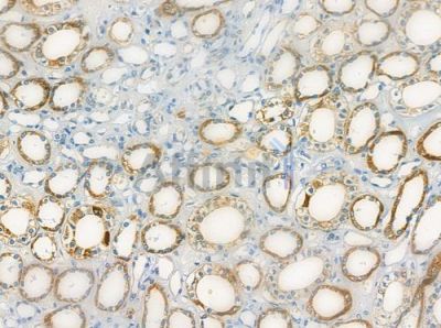 RRP7 Antibody - DF2485 at 1/100 staining human normal kidney tissue by IHC-P.