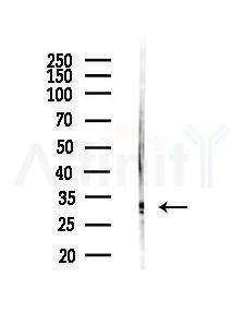FGF5 Antibody - Western blot analysis of lysates from Mouse liver, using FGF5 Antibody at 1/1000 dilution.
