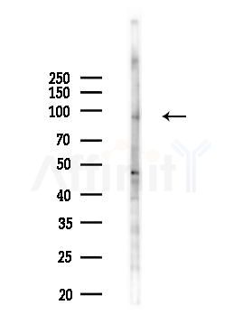 HSPA4L Antibody - Western blot analysis of lysates from B16F10-LUC cells(starvation,24h treatment), using HSPA4L Antibody at 1/1000 dilution.