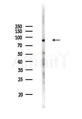 HSPA4L Antibody - Western blot analysis of lysates from Rat liver, using HSPA4L Antibody at 1/1000 dilution.