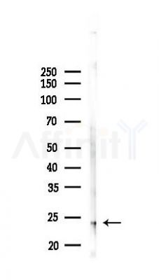 HSPB7 Antibody - Western blot analysis of lysates from Mouse testis, using HSPB7 Antibody at 1/1000 dilution.