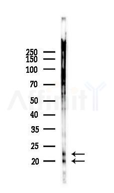 HSPB7 Antibody - Western blot analysis of lysates from COLO205 cells(heat-shock,45min treatment), using HSPB7 Antibody at 1/1000 dilution.