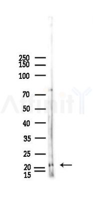 IFNA4/10/14 Antibody - Western blot analysis of lysates from HUVEC cells(heat-shock,45min treatment), using IFNA4/10/14 Antibody at 1/1000 dilution.