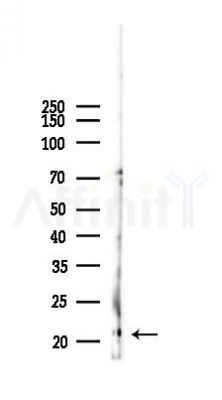 IFNA4/10/14 Antibody - Western blot analysis of lysates from B16F10-LUC cells(starvation,24h treatment), using IFNA4/10/14 Antibody at 1/1000 dilution.