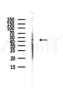 IL12B Antibody - Western blot analysis of lysates from HUVEC cells(UV,30min treatment), using IL12B Antibody at 1/1000 dilution.