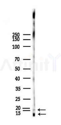 IL13 Antibody - Western blot analysis of lysates from HUVEC cells(heat-shock,45min treatment), using IL13 Antibody at 1/1000 dilution.