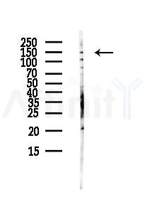 IL16 Antibody - Western blot analysis of lysates from HUVEC cells(UV,30min treatment), using IL16 Antibody at 1/1000 dilution.