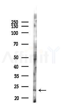 IL1F6 Antibody - Western blot analysis of lysates from 293 cells(UV,30min treatment), using IL1F6 Antibody at 1/1000 dilution.