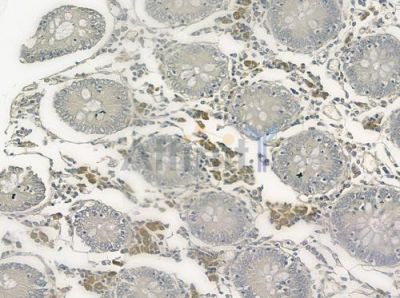 IL6R Antibody - DF2530 at 1/100 staining human normal kidney tissue by IHC-P.