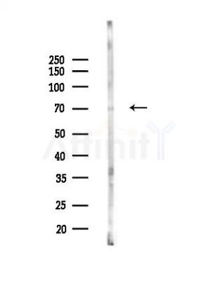 ST2 Antibody - Western blot analysis of lysates from Mouse lung, using ST2 Antibody at 1/1000 dilution.