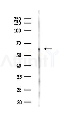 K2C1B Antibody - Western blot analysis of lysates from Mouse liver, using K2C1B Antibody at 1/1000 dilution.