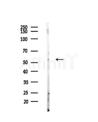 KRT82 Antibody - Western blot analysis of lysates from B16F10-LUC cells, using KRT82 Antibody at 1/1000 dilution.