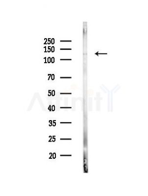 SETDB2 Antibody - Western blot analysis of lysates from PC12 cells(UV,30min treatment), using SETDB2 Antibody at 1/1000 dilution.