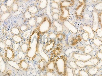 CNNM3 Antibody - DF2572 at 1/100 staining human normal kidney tissue by IHC-P.