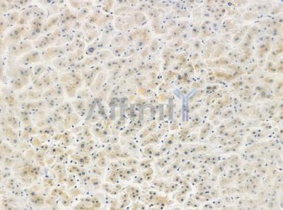 MAPRE2 Antibody - DF2576 at 1/100 staining human normal liver tissue by IHC-P.