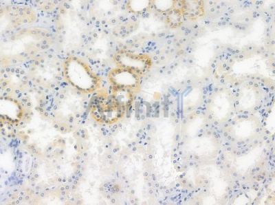 MAPRE2 Antibody - DF2576 at 1/100 staining human normal kidney tissue by IHC-P.