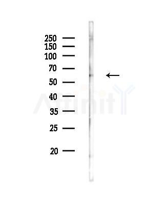 ZDHHC13 Antibody - Western blot analysis of lysates from Rat muscle, using ZDHHC13 Antibody at 1/1000 dilution.