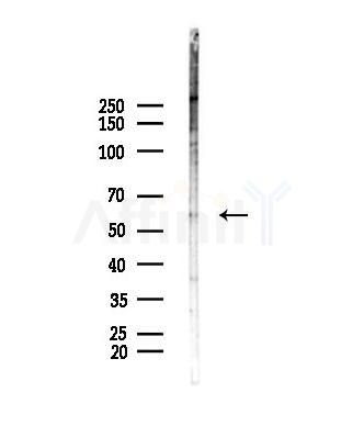 ZDHHC13 Antibody - Western blot analysis of lysates from Mouse lung, using ZDHHC13 Antibody at 1/1000 dilution.